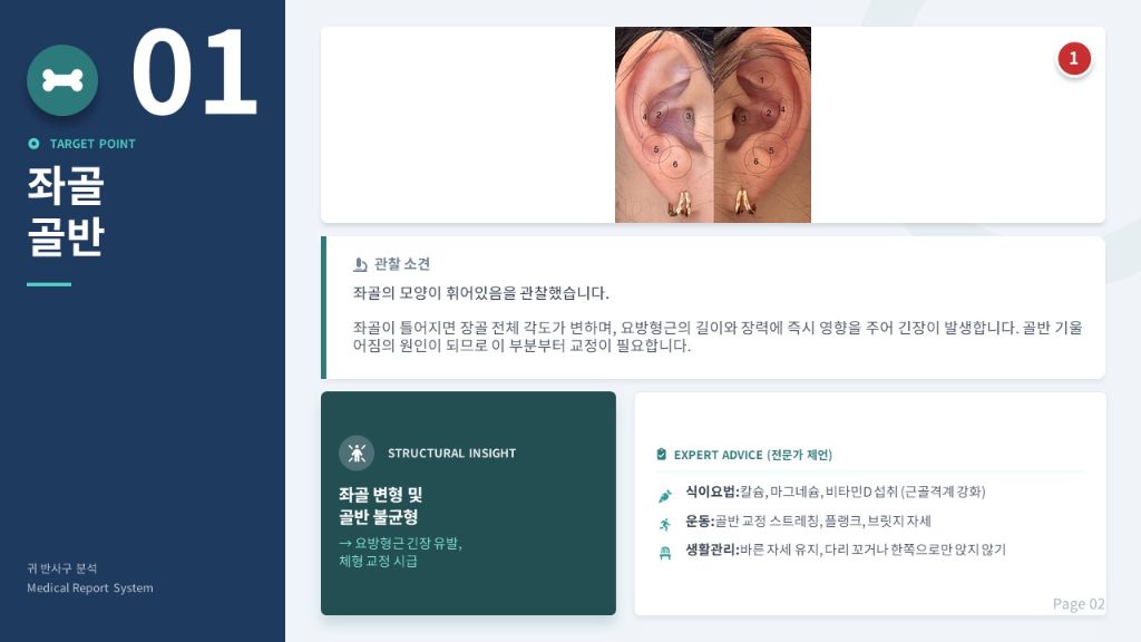 좌골 골반 분석