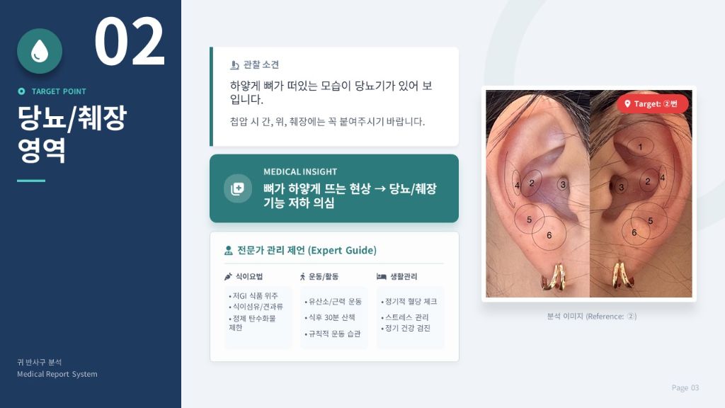 당뇨/췌장 영역 분석