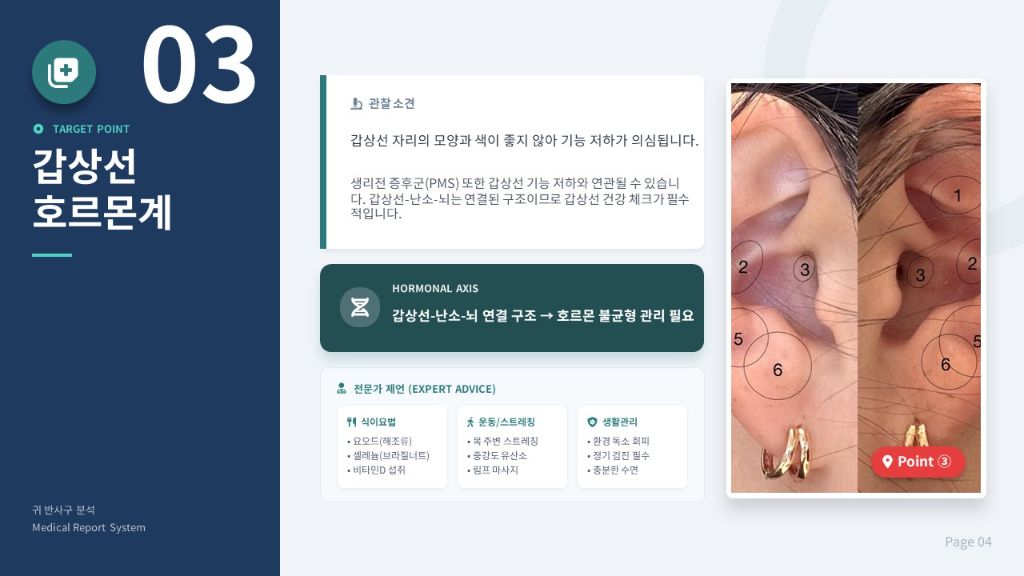 갑상선 호르몬계 분석